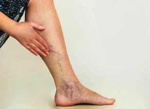 Les veines des pieds